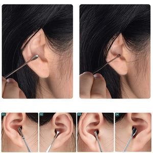 EarWax™ Kit de Limpieza de Oídos Profesional –